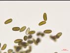 Diplodia_seriata_D43390-2_Conidies_LQ