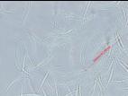 Fusarium_equiseti_4