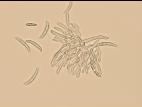 Fusarium_sp_3