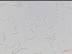 Fusarium_oxysporum_3