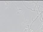 Fusarium_proliferatum_4