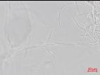Fusarium_proliferatum_3