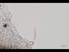 Fusarium_sp_4