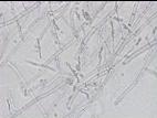 Geotrichum_sp_3