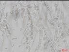 Geotrichum_sp_4