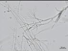 Gibellulopsis_sp_1