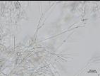 Gibellulopsis_sp_2