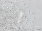 Gibellulopsis_sp_3