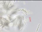 Glomerella_sp_1