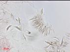 Glomerella_sp_2