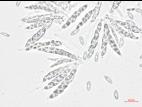 Glomerella_miyabeana_1