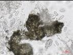 Leptosphaerulina_sp_1