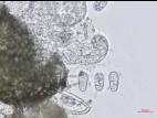 Leptosphaerulina_sp_3