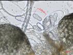 Leptosphaerulina_sp_4