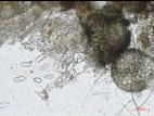 Leptosphaerulina_sp_5