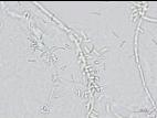 Microdochium_sp_4