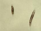 Pestalotiopsis_sp_6