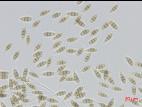 Pestalotiopsis_sp_7
