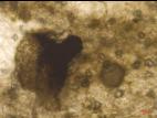 Physalospora_vaccinii_3