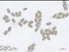 Physalospora_vaccinii_2