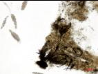 Physalospora_vaccinii_1