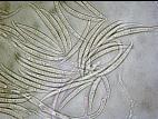 Fusarium_acuminatum_1