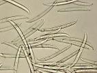 Fusarium_lateritium_2