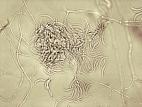 Fusarium_sp_2