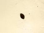 Gilbertella_sp_2