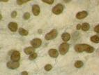 Phoma_sp_4