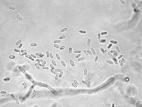 Phoma_sp_5