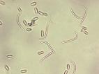 Phomopsis_sp_3