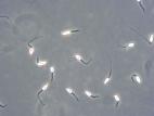 Phyllosticta_sp_2