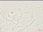 Plectosporium_tabacinum_1
