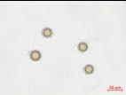 Pythium_uncinulatum_1