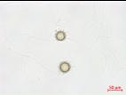 Pythium_uncinulatum_2