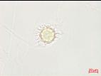 Pythium_uncinulatum_3