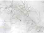 Rhizoctonia_sp_5