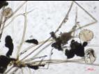 Rhizopus_sp_3