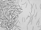 Septoria_sp_2