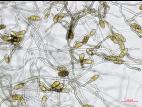 Stemphylium_sp_4