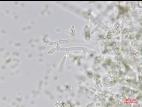 Trichoderma_virens_1