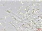 Trichoderma_virens_2
