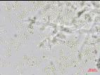 Trichoderma_virens_3