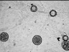 Pythium_irregulare_1
