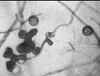 Pythium_torulosum_1