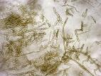 Ramularia_sp_2