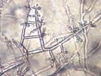 Trichoderma_sp_2