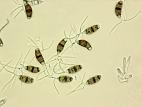 Truncatella_sp_1
