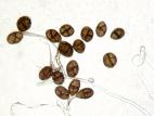 Ulocladium_sp_6